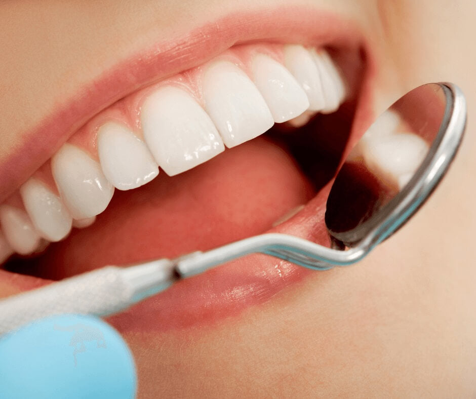 How to Remove Tartar from Teeth without Dentist