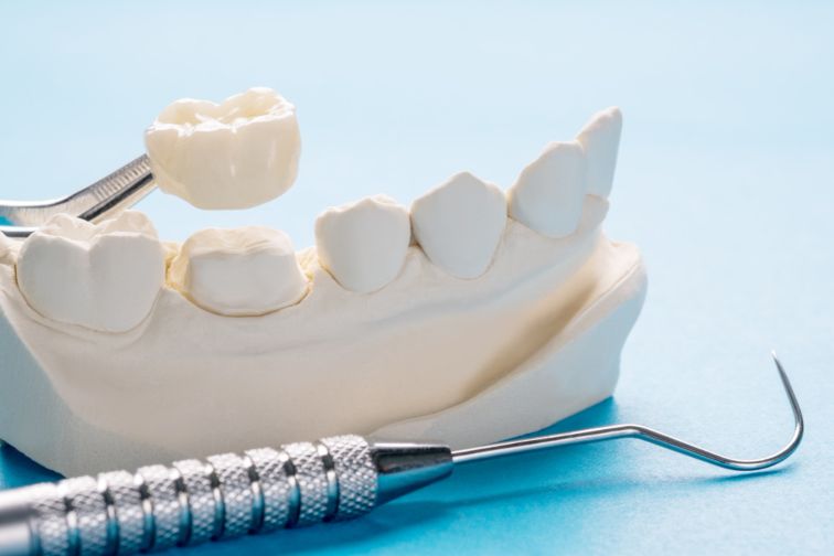 Things to Know Why Tooth Hurts Worse after Temporary Crown