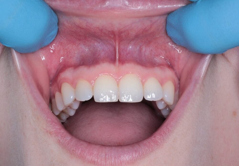 is oral cancer curable