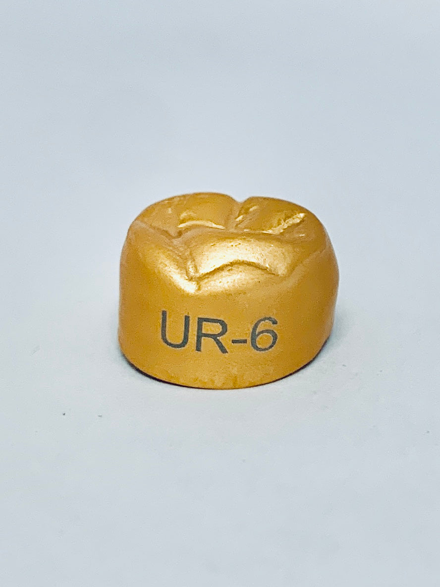 Temp Anodized Gold Crown UR6